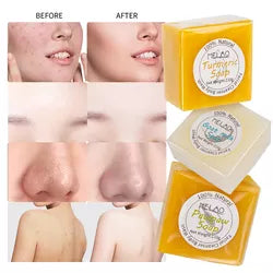 MELAO Cleansing Soaps Natural Mite Remover Nourishing Turmeric Goat Milk Toilet Soap Organic Foaming Facial Care Soap